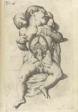 Anatomía de tórax y abdomen de una recién nacida. Lámina del siglo XVII Anatomía de tórax y abdomen de una recién nacida. Lámina del siglo XVII